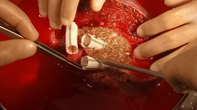 ڈاکٹرز آپریشن کرتے ہوئے