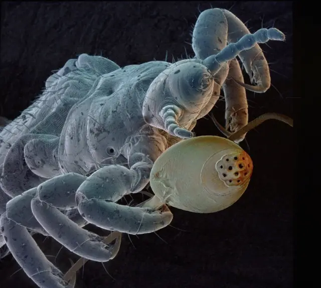 Foto na-egosi igu yiri akwa na ntutu mmadụ