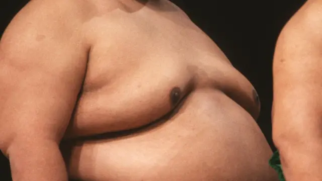 පුරුෂ පියයුරු