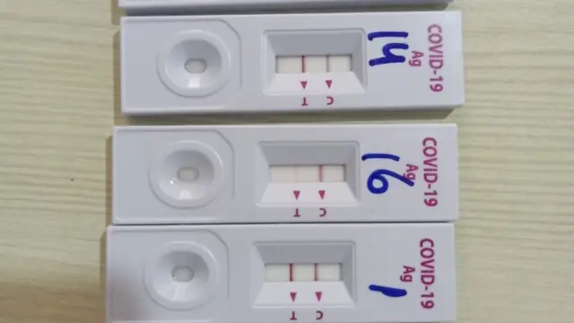 एंटीजन टेस्ट