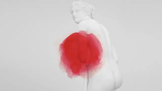 Ендометріоз