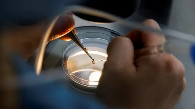 An employee demonstrates the work process before freezing eggs in a Fertility Research lab at Cha Fertility Center in Bundang, South Korea, April 30, 2022.