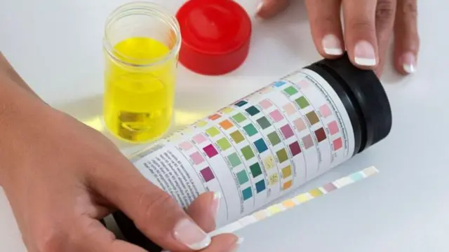 मूत्राशयाचा संसर्ग 