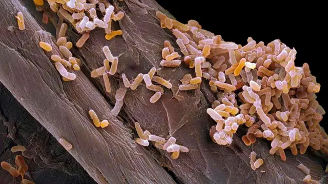 Salmonella bakterisinin mikroskop altında çekilip büyütülmüş görseli 