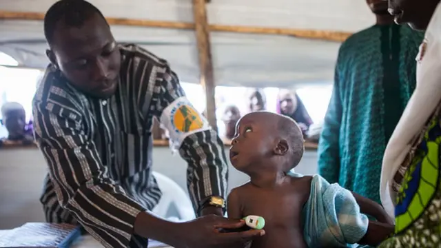 Dibia bekee na-eleta obere nwata.