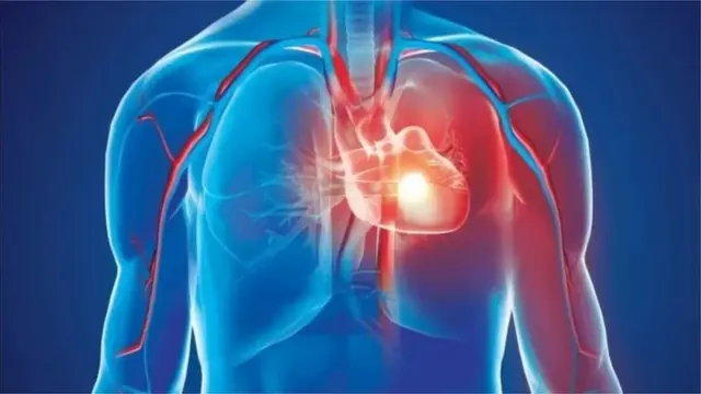 বিশ্বে ট্রান্সফ্যাট গ্রহণের কারণে হৃদরোগে আক্রান্ত হয়ে মৃত্যুর প্রায় দুই তৃতীয়াংশই হয় বাংলাদেশ সহ পনেরটি দেশে ।