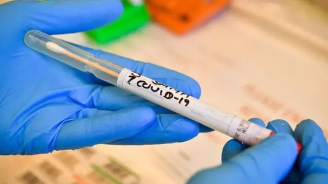 कोरोनाभाइरस