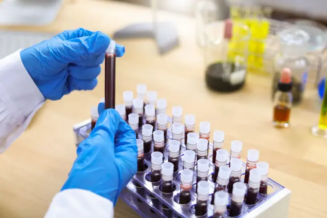 Кан тапшыруу