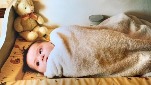 ډاون سنډروم