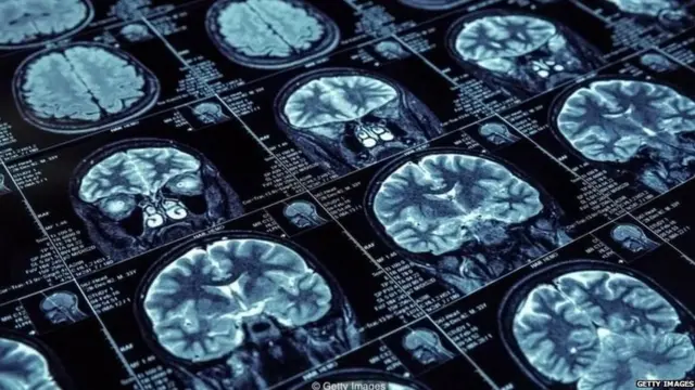 झोप, आरोग्य, कोरोना