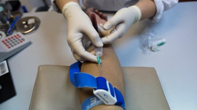 Testeb2xbet paga mesmoHIV