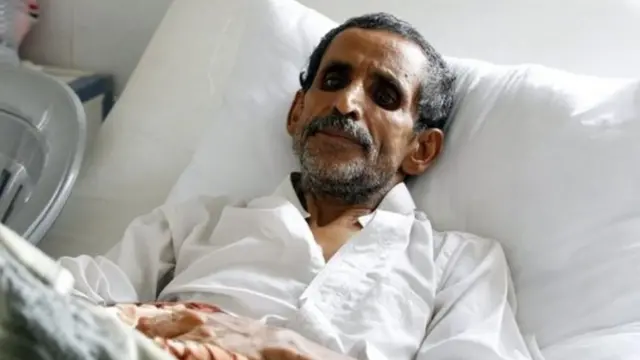 تقول الأمم المتحدة إن الوباء تفشى في جميع أنحاء البلد