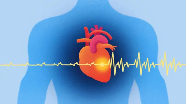 ਦਿਲ ਦਾ ਦੌਰਾ