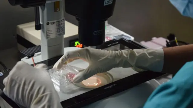 Seorang ahli Kesehatan menunjukkan sel telur setelah dibekukan di Kuala Lumpur, Malaysia.