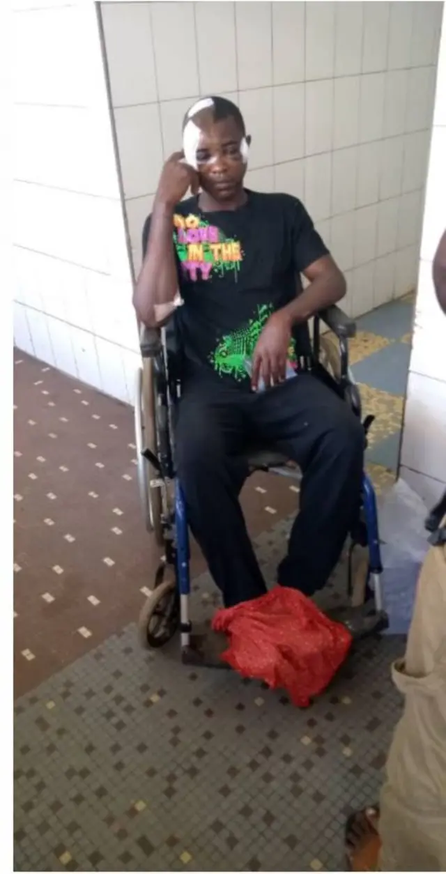 Nwaafọ Igbo e merụrụ nnukwu ahụ na Togo