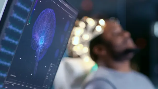 Escáner cerebral en hombre.