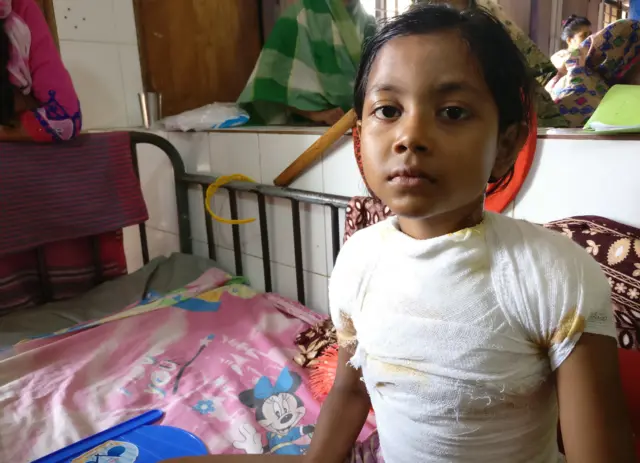 কেয়া মনির শরীর পুড়ে গেছে তীব্র শীতে গরম পানিতে গোসল করতে গিয়ে