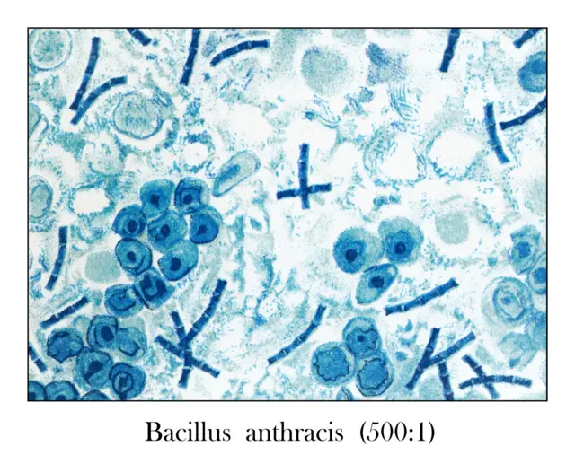 Antigua ilustración grabada de Bacillus anthracis en la sangre (500: 1) bajo el microscopio