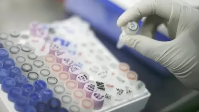 ডিএনএ নমুনা সংগ্রহের কাজ চলছে। ফাইল ছবি