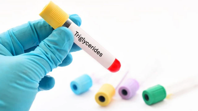 การตรวจวัดระดับไตรกลีเซอไรด์ซึ่งเป็นไขมันชนิดหนึ่งในเลือด จะให้ข้อมูลที่เป็นแนวทางในการดูแลรักษาสุขภาพได้