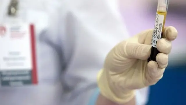 બ્લડ સૅમ્પલ