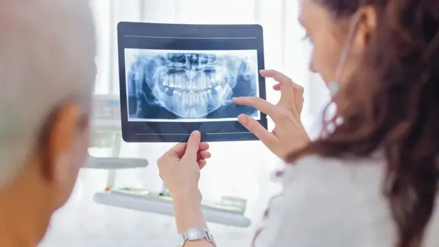 Bahaya dari periodontitis adalah penyakit ini tidak terdeteksi pada banyak pasien, karena biasanya muncul tanpa gejala