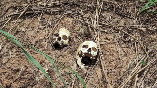 Skulls of victims of fighting in Kasai