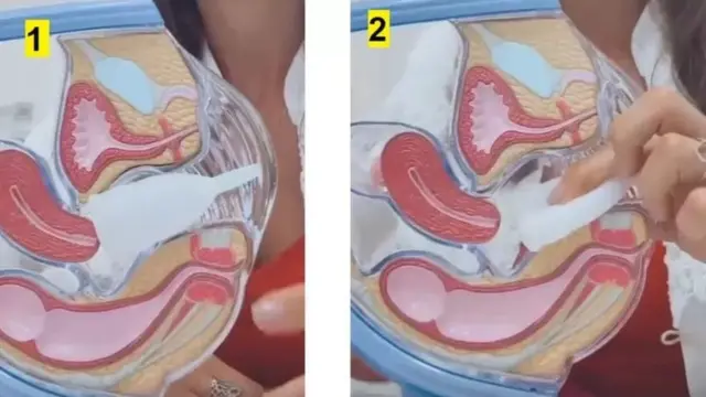 मेनस्ट्रुअल कप, सॅनिटरी पॅड, मासिक पाळी, आरोग्य, महिला