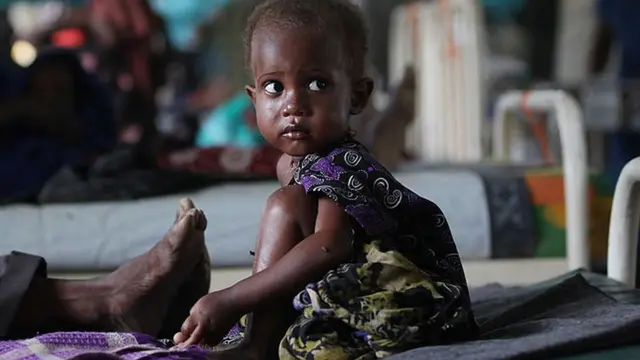 La mortalité infantile associée à la sous nutrition réduit de 7,5 % la population active en RDC