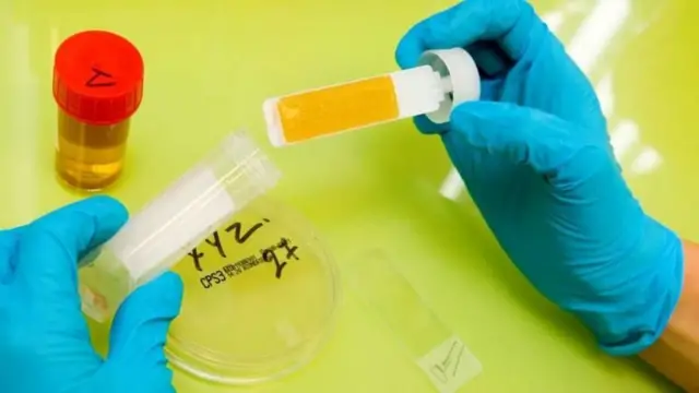 सांकेतिक तस्वीर