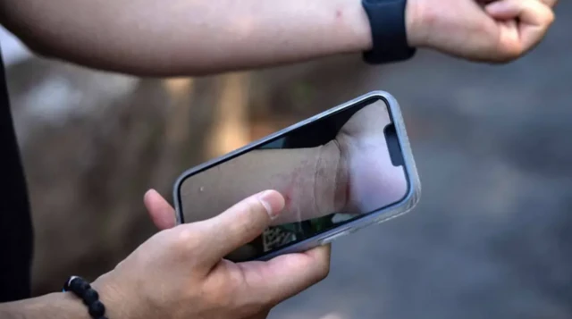 எம்பாக்ஸ் தொற்றுநோய்