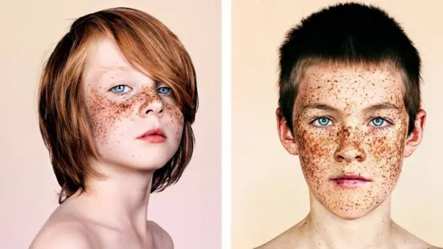 கரும்புள்ளிகள்