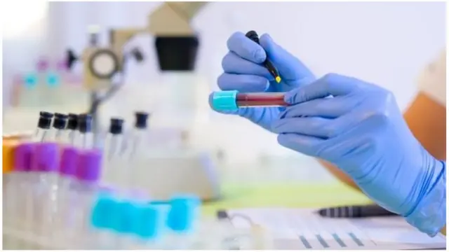 "මේ ප්රයත්නය විස්මය දනවන සුළු යෝධ පියවරක්" හැටියට එක්සත් රාජධානියේ විශේෂඥයන් විසින් හඳුන්වා දෙනු ලැබ ඇත.