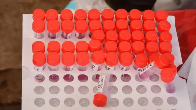 Qalabka lagu baaro Corona