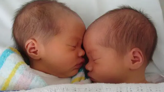 La distinction entre vrais et faux jumeaux n'est pas toujours claire. Les bébés Maddie et Mia, que l'on pensait être des faux jumeaux, se sont avérés être des vrais jumeaux