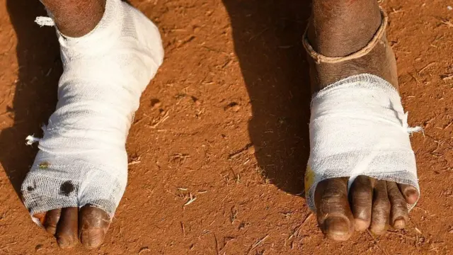 మహారాష్ట్రలో పాదయాత్ర చేయడంతో కందిన రైతు పాదాలు (పాత చిత్రం)