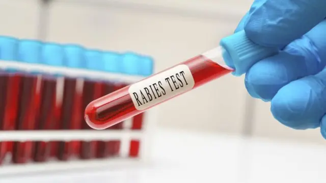 रेबीज 