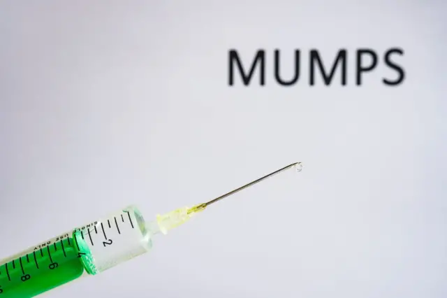 Penyakit Mumps: Ribuan Anak Terinfeksi Penyakit Gondongan – Apa Itu ...