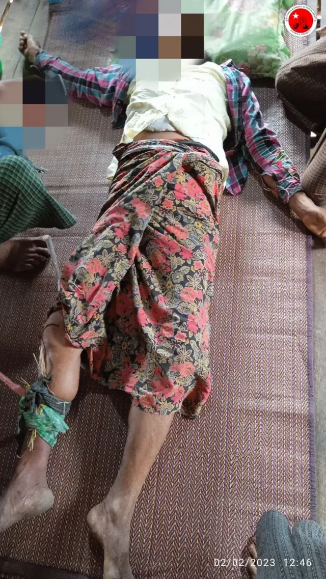 ကန့်ဘလူ၊ စစ်ဘေးရှောင်၊ မြွေကိုက်ခံရ