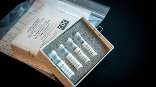 Akụrụngwa eji enyocha onye nwere Corona virus