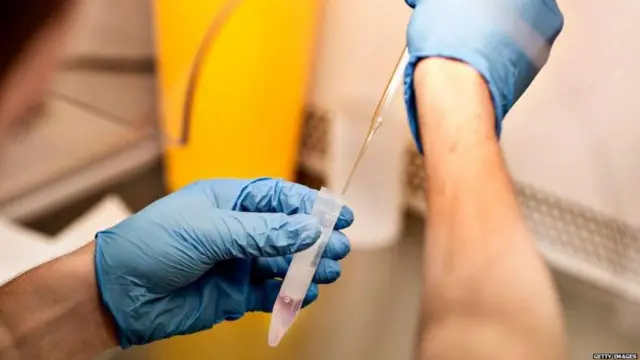 ਸ਼ੁਕਰਾਣੂ