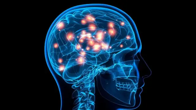 Una imagen de un cráneo