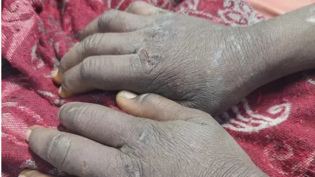 தென்சாசி சம்பவம்