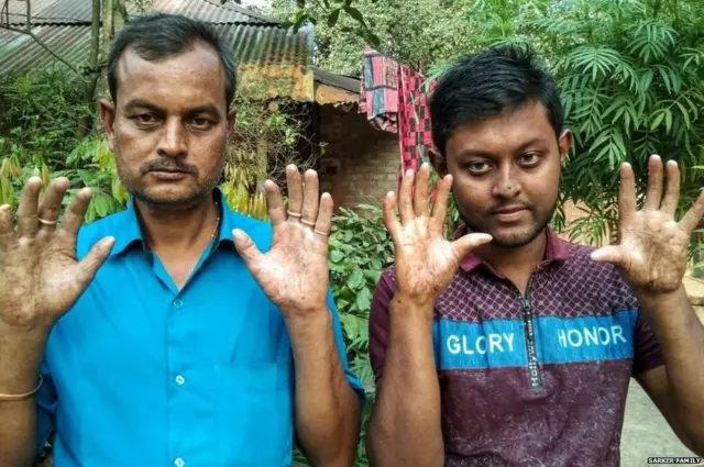 फिंगरप्रिंट, आजार