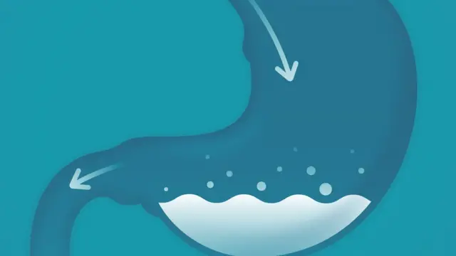 Ilustración del estómago con jugo gástrico