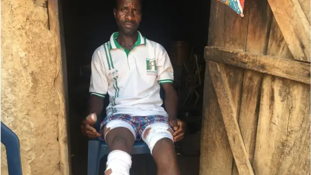 Alleged victim if police brutality for Kabusa