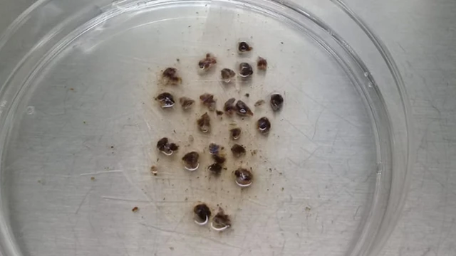 Trozos de tumor fresco de melanoma acral de un paciente mexicano