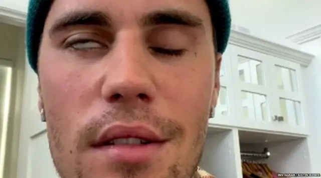 ਜਸਟਿਨ ਬੀਬਰ