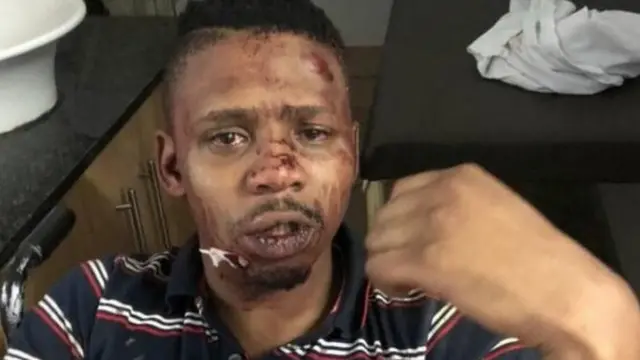 Mwandishi wa habari wa Afrika Kusini Samora Mangesi alituma picha zake za majeraha aliyoyapata katika kile alichodai ni shambulio Mwaka jana