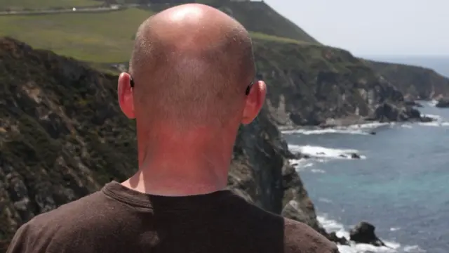 एक गंजा व्यक्ति.